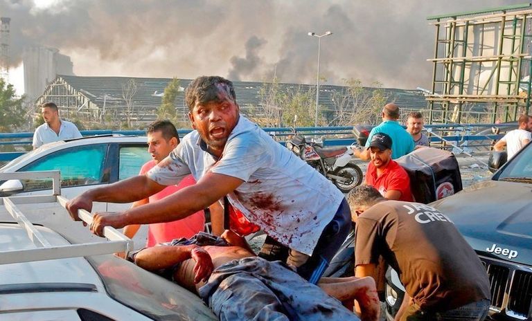 مصابون في شوارع بيروت عقب انفجار مرفأ بيروت المروع