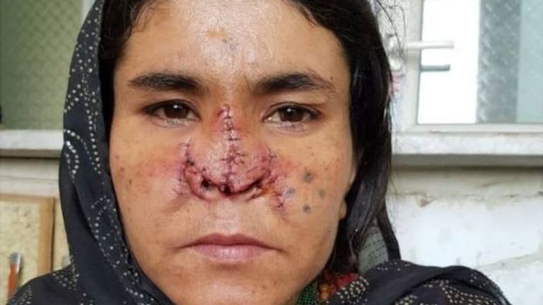 السيدة الأفغانية لزاركا  