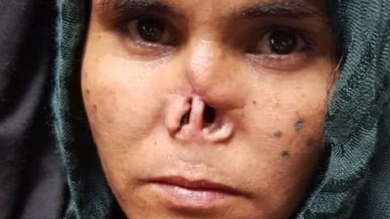 السيدة الأفغانية لزاركا  