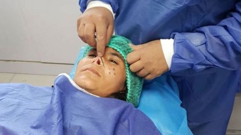 السيدة الأفغانية لزاركا  