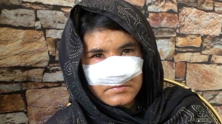 السيدة الأفغانية لزاركا  