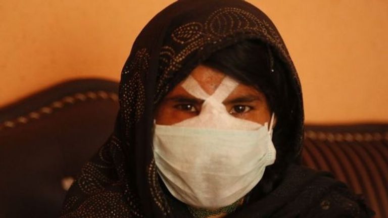 السيدة الأفغانية لزاركا  