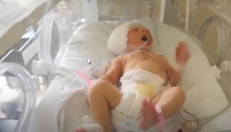الطفلة اللبنانية صوفي عجوري بعد إصابتها