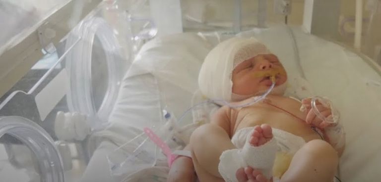 الطفلة اللبنانية صوفي عجوري بعد إصابتها