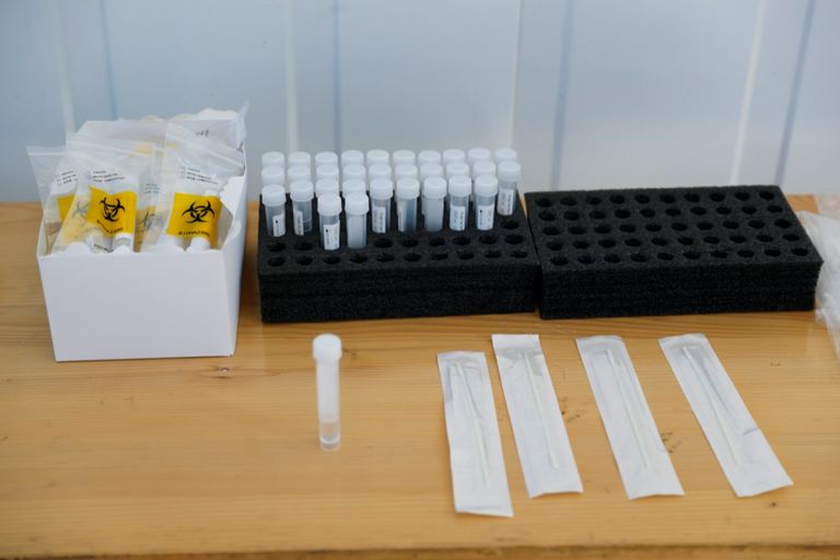 كورونا حول العالم