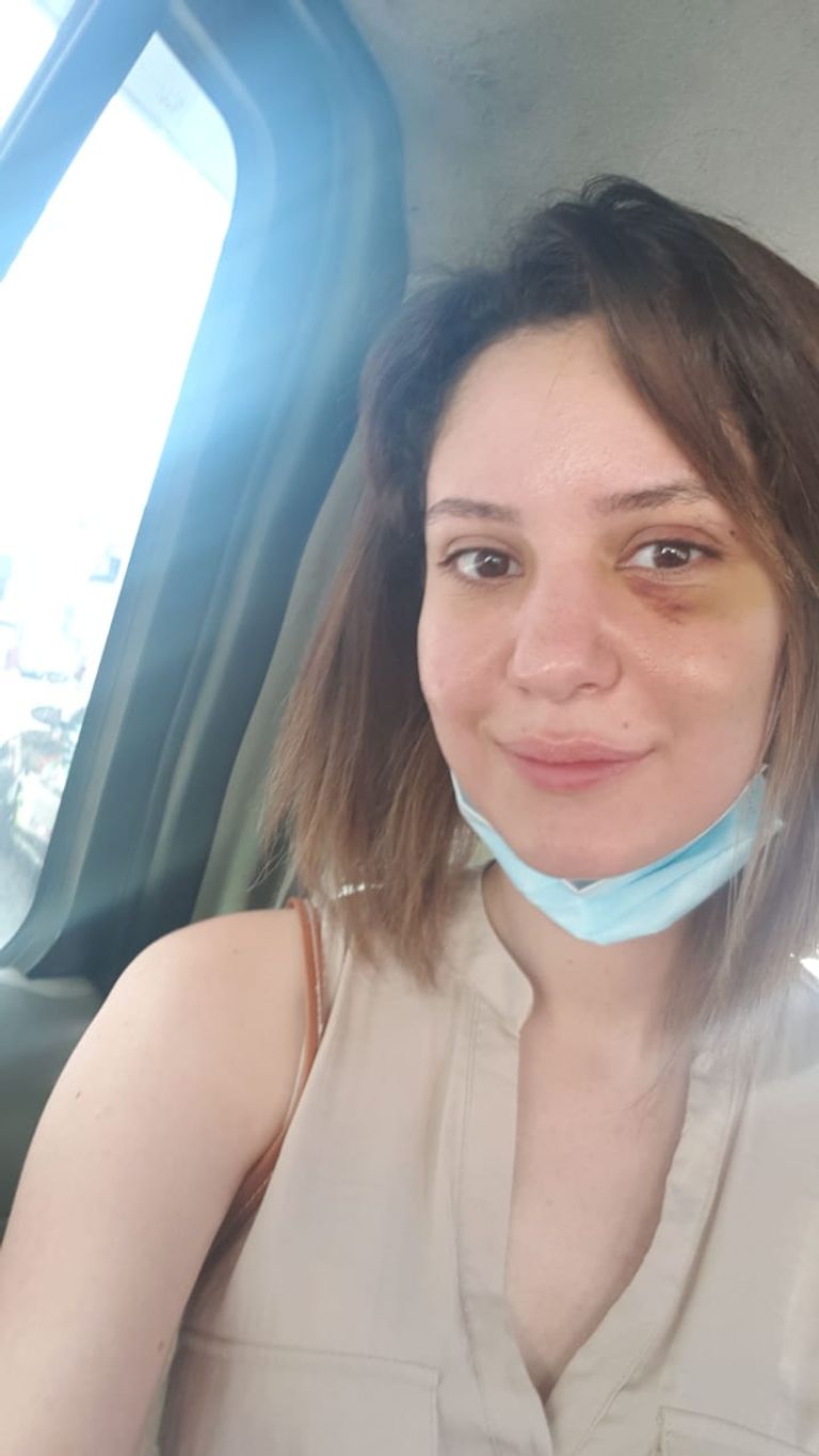 الطبيبة اللبنانية دارين عياش، ناجية من انفجار مرفأ بيروت، حيث غابت عن الوعي قرابة الساعة بعد إصابتها في انفجار بيروت دارين عياش طبيبة نجت من انفجار بيروت بأعجوبة