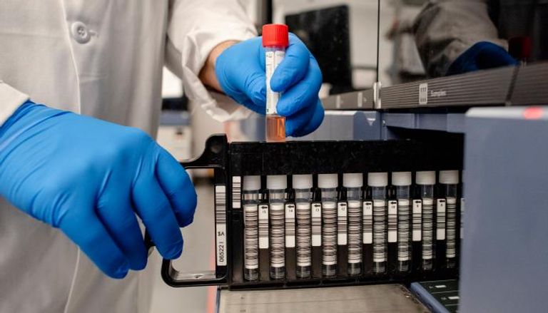 لقاح كورونا الروسي - أرشيفية روسيا تعلن بدء إنتاج لقاح ضد فيروس كورونا المستجد