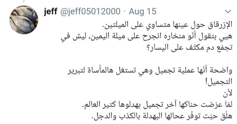 نادين نجيم وطفلاها في صورة نشرتها بعد إصابتها بمرفأ بيروت