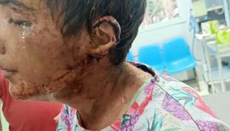 تحريات الشرطة المصرية أكدت تعذيب المتهمين للفتاة