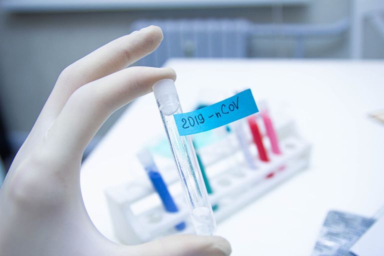 عاد كارارا إلى منزله بعد تعافيه من كورونا