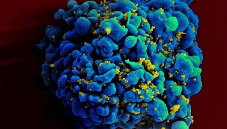 خلية بشرية مصابة بالإيدز - نيويورك تايمز