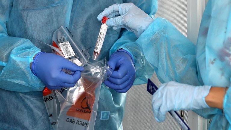 كورونا حول العالم