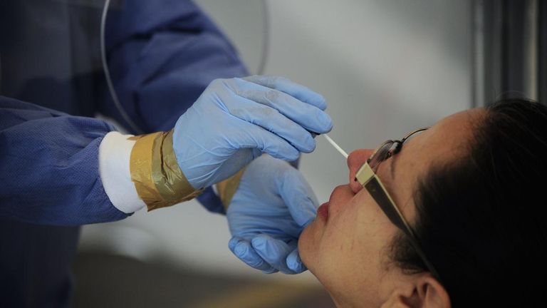 كورونا حول العالم