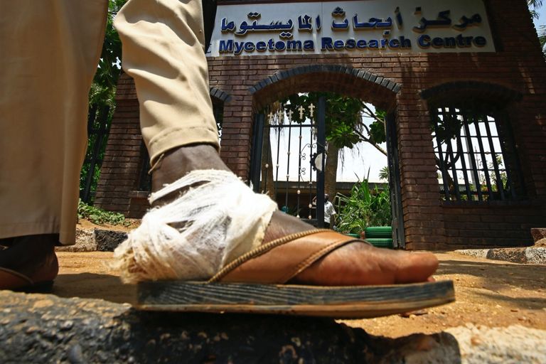 مركز أبحاث المايستوما