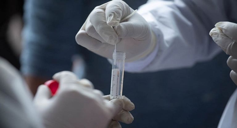 اختبار فيروس كورونا