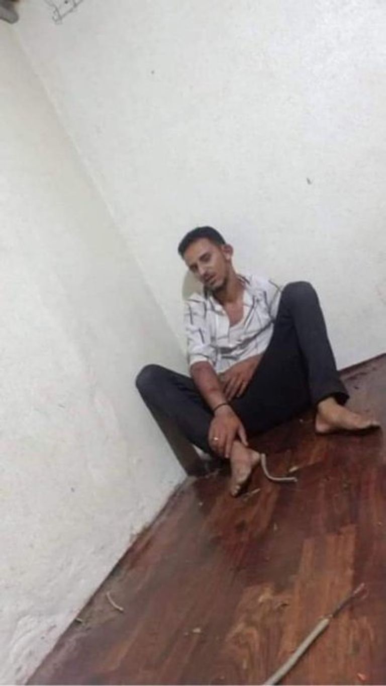 جرائم الحوثي بحق المعتقلين.. عرض مستمر