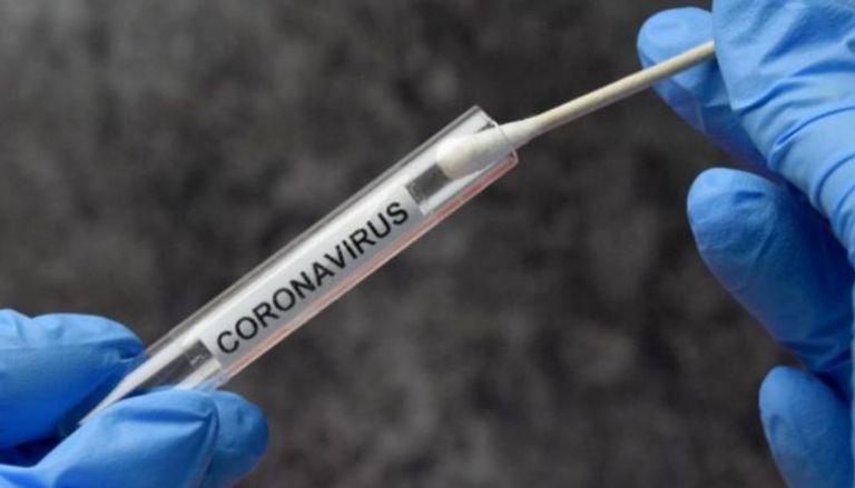اختبار فيروس كورونا - أرشيفية