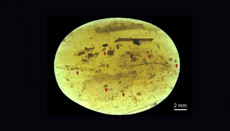 صورة ميكروسكوبية مكبرة للحيوان المنوي المكتشف