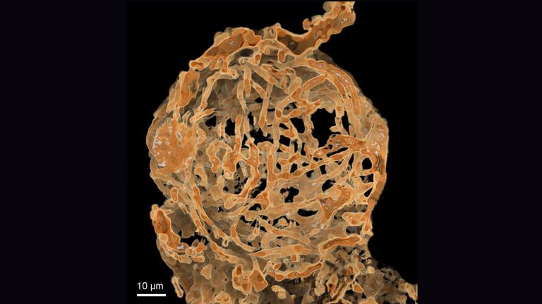 صورة ميكروسكوبية مكبرة للحيوان المنوي المكتشف