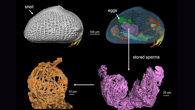 صورة ميكروسكوبية مكبرة للحيوان المنوي المكتشف