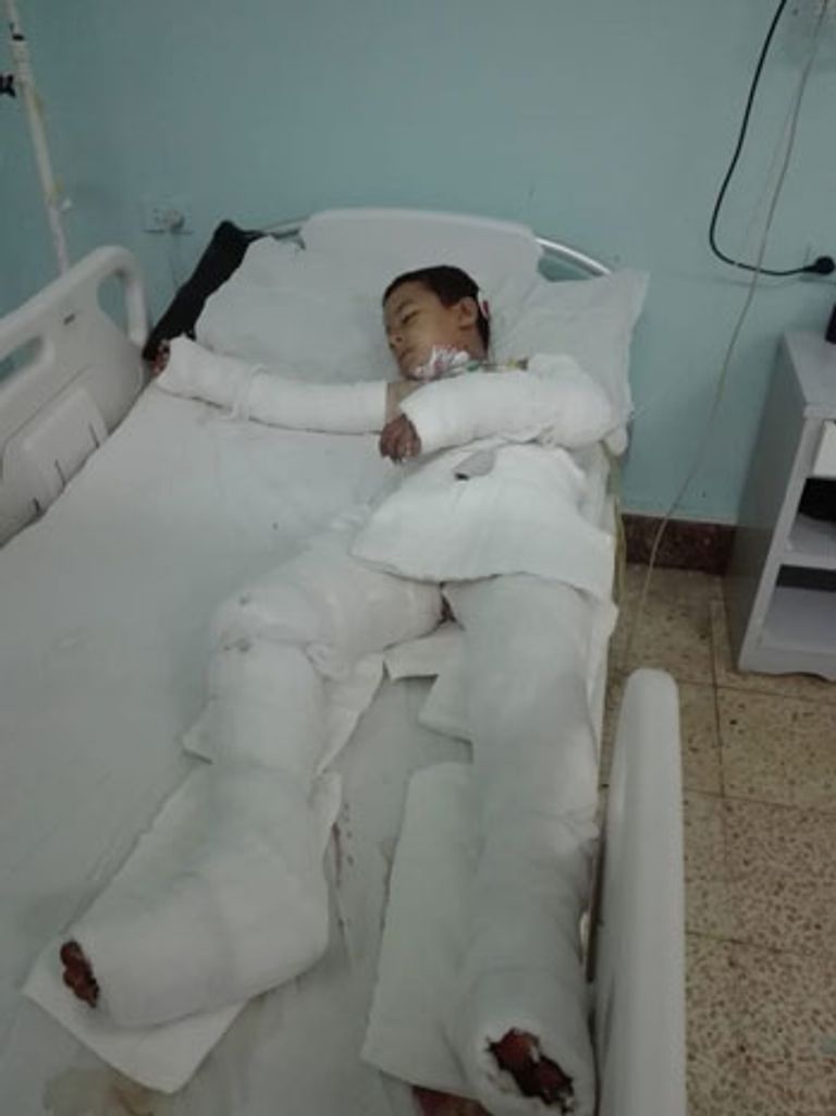 الطفل محمد في المستشفى