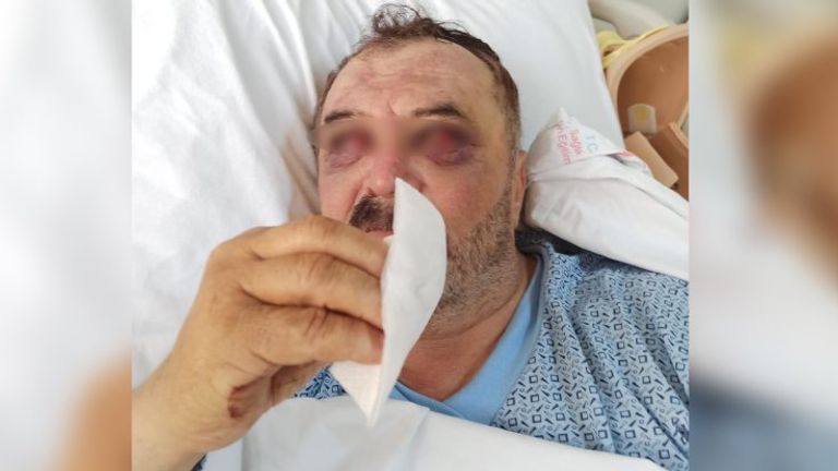 أحد المصابين الذي ألقاهم الجنود من الطائرة