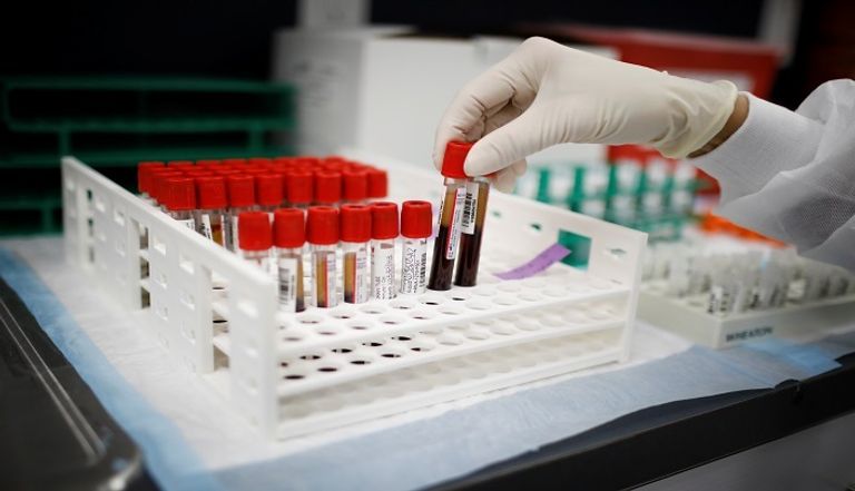 شخص يخضع لاختبار فيروس كورونا