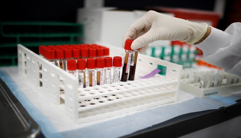 اختبار فيروس كورونا