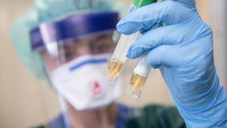 كورونا حول العالم