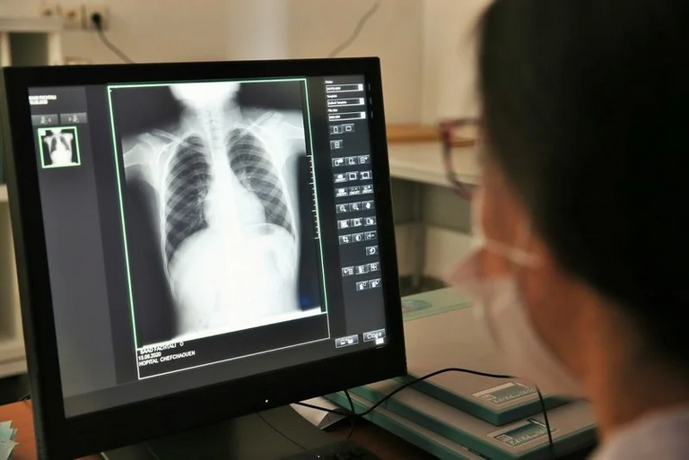 بعض التحورات قد تمنح فيروس كورونا ميزة للبقاء على قيد الحياة