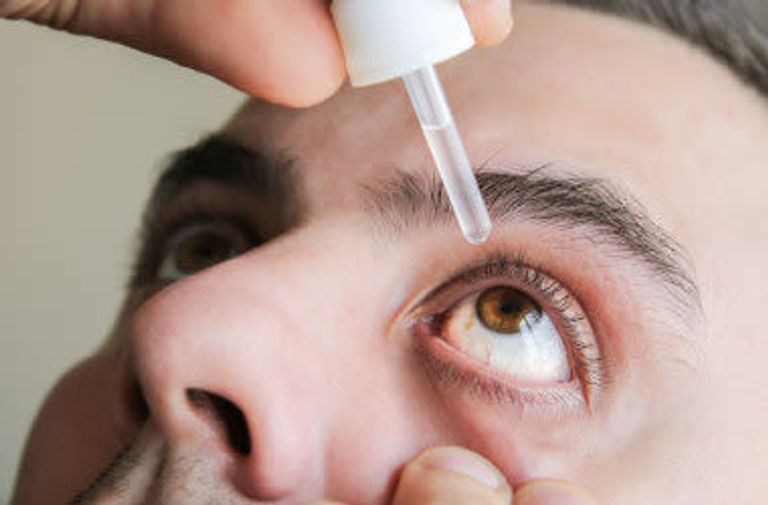 جفاف العين من أعراض متلازمة شوغرن - تعبيرية امرأة تعاني من متلازمة شوغرن