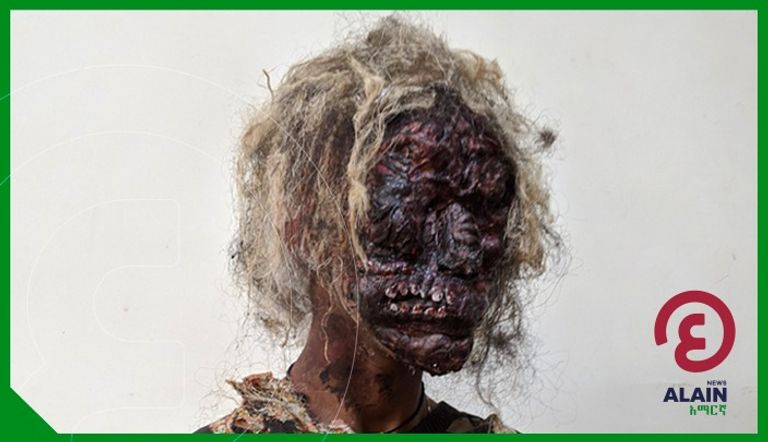 بيتلحيم أببي