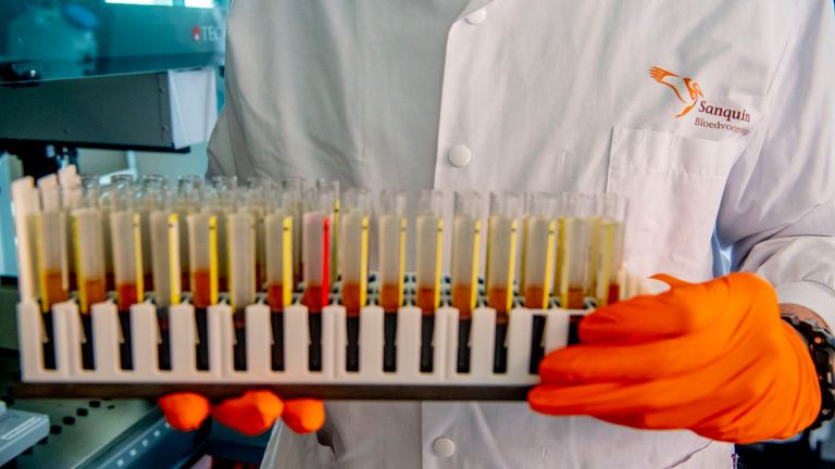 الدراسة تقول إن متعافي كورونا يتمتعون بالحصانة المناعية لمدة 6 أشهر على الأقل