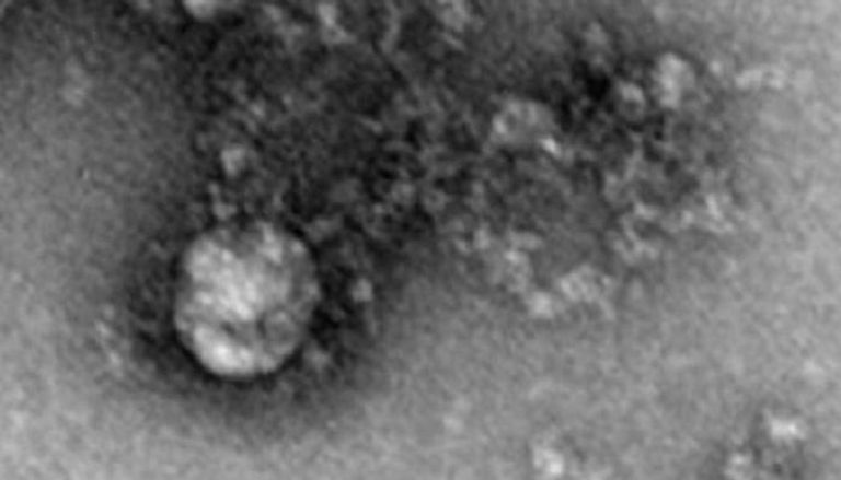  أول صورة مجهرية لسلالة فيروس كورونا الجديدة