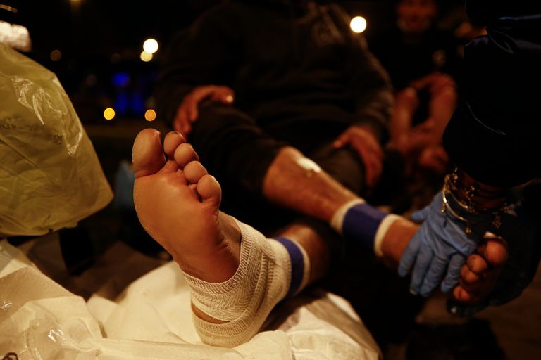 لاجئ مصاب بقدمه