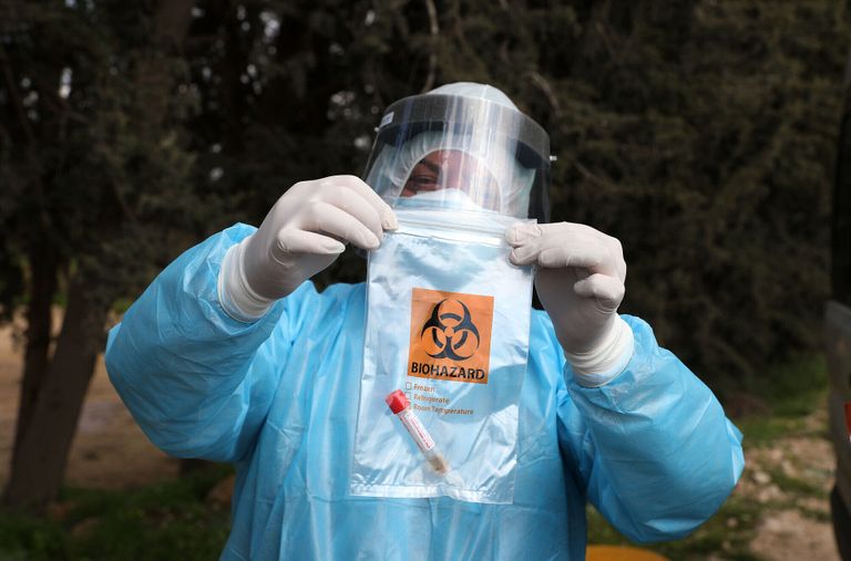 كورونا حول العالم ارتفاع إصابات كورونا حول العالم إلى 103 ملايين و135 ألفا و7 إصابات