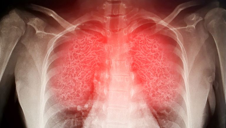 الرئة موطن الذاكرة المناعية لمواجهة كورونا 
