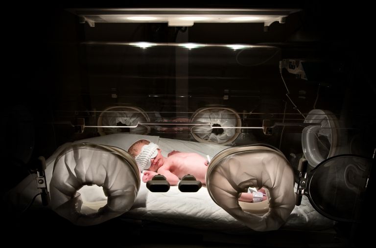 حصول الحوامل على مزيد من ضوء الشمس في الأشهر الأولى يقلل مشاكل المشيمة