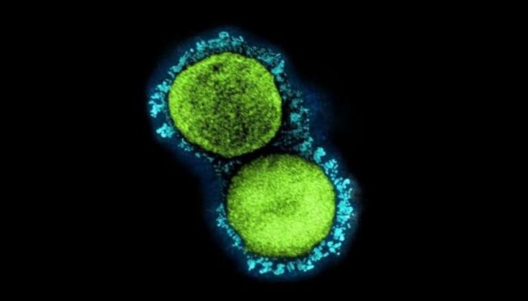صورة مجهرية لجزيئات فيروس كورونا معزولة من مريض
