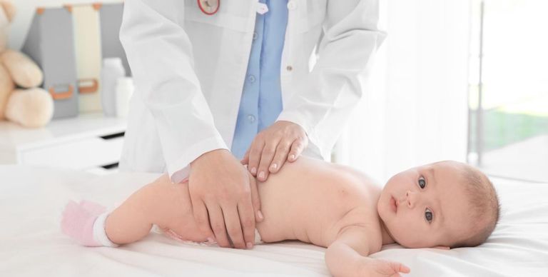 علاج الفتق الأربي عند الرضع رضيع يعاني من الفتق الأربي (تعبيرية)
