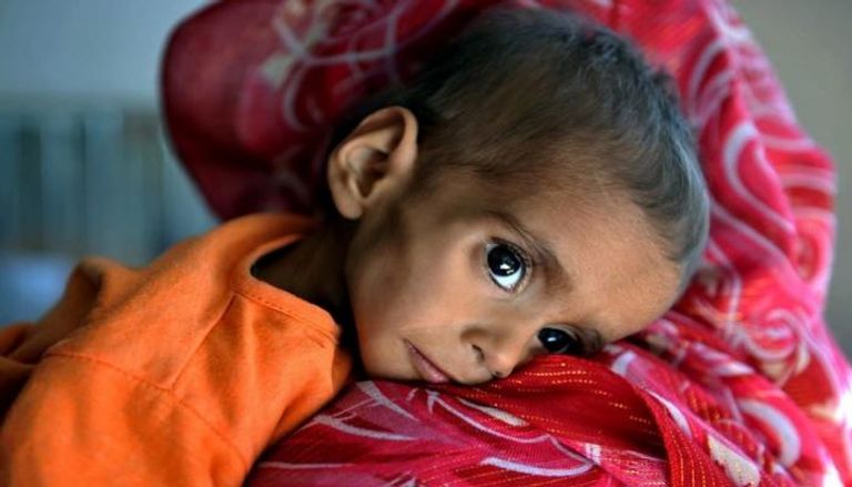 طفل أفغاني يعاني من سوء التغذية- أرشيفية