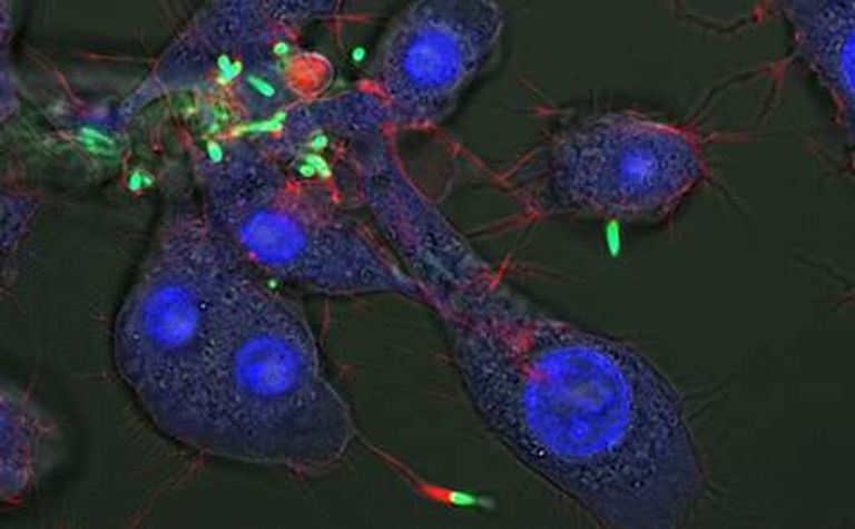 بكتيريا بوركولديريا تختبئ من المضادات الحيوية