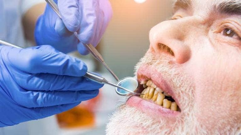 صحة الفم السيئة تزيد احتمالات الإصابة بمضاعفات كورونا