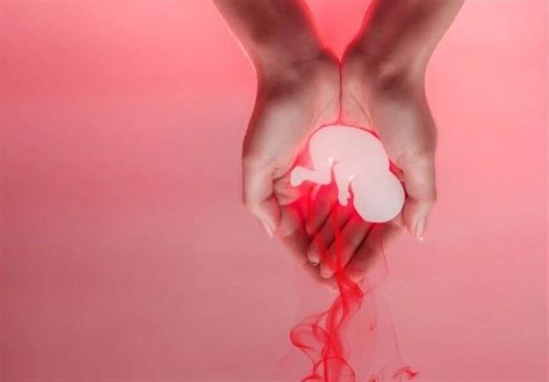 مسؤولة إيرانية تؤكد أن 40% من النساء يجهضن بسبب عدم الاستعداد المالي