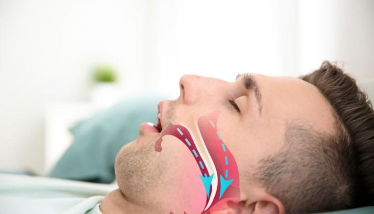 انقطاع التنفس أثناء النوم يمكن أن تكون له تداعيات خطيرة