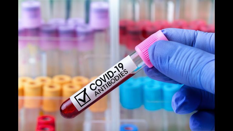 الجنس والعمر يحددان مدى قوة مستويات الأجسام المضادة لكورونا