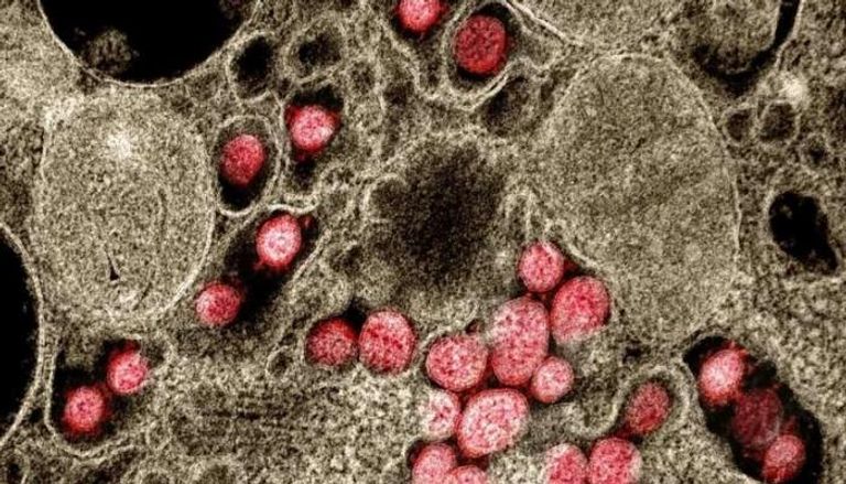 صورة مجهرية إلكترونية لجزيئات فيروس كورونا المعزولة من المريض