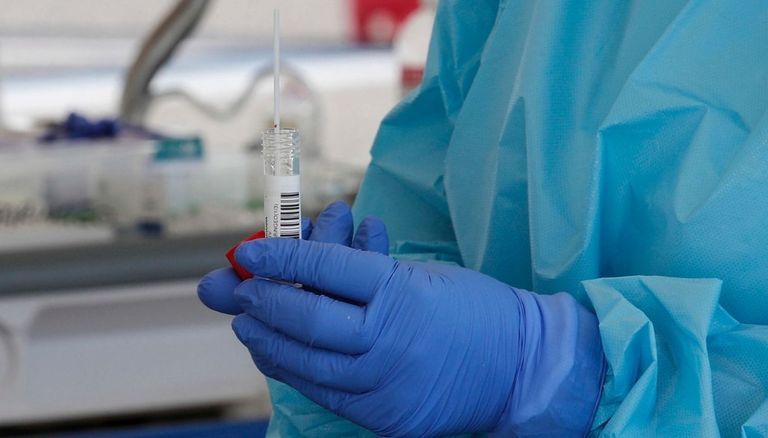 علماء يتوصلون لكيفية منع دخول كورونا إلى الخلايا بواسطة "الأبتمرات"