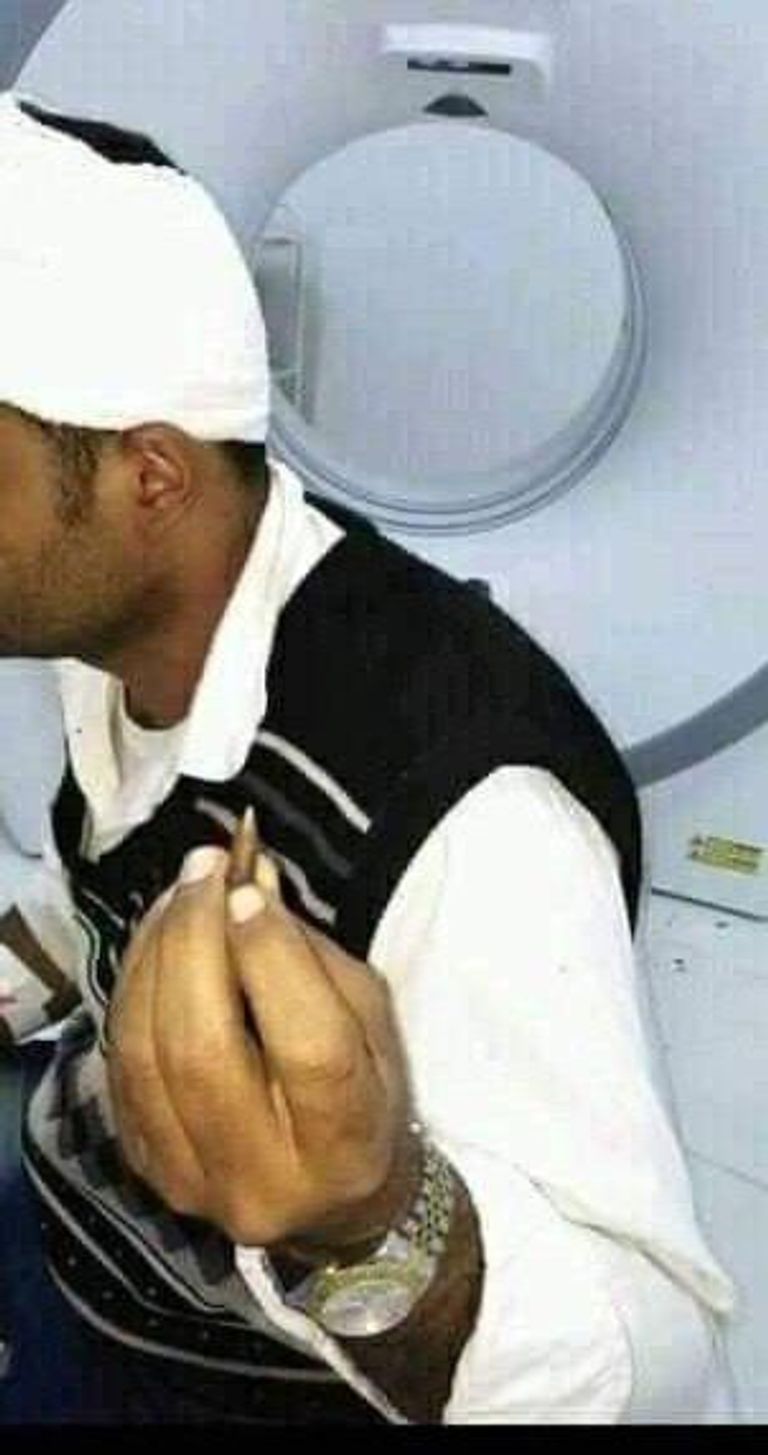 صورة متداولة على مواقع التواصل الاجتماعي لأحد المصابين في الاحتفالات صورة متداولة على مواقع التواصل الاجتماعي للاحتفالات في اليمن