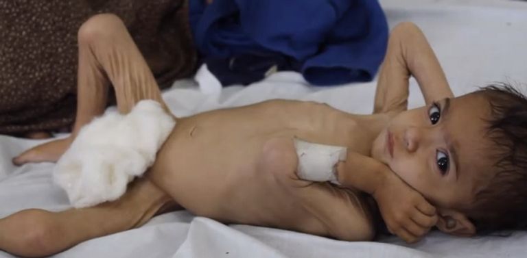 مخيم للنازحين داخليا في أفغانستان - سي إن إن